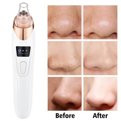 Electric Blackhead Remover Vacuum Cleaner – Pore Cleaner for Face & Nose, Rechargeable Acne Extractor with 3 Suction Levels & 5 Probes