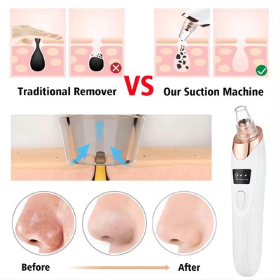 Electric Blackhead Remover Vacuum Cleaner – Pore Cleaner for Face & Nose, Rechargeable Acne Extractor with 3 Suction Levels & 5 Probes